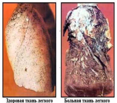 О вреде табакокурения!