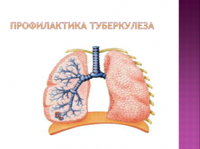Профилактика туберкулеза